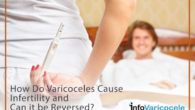 How Do Varicoceles Cause Infertility and Can it be Reversed