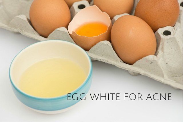 Best Home remedies to Treat Acne - Egg-White-For-Acne Face Pack