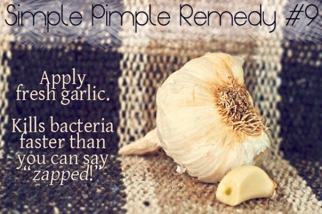 Best Home remedies to Treat Acne - Garlic Paste face pack