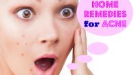 home-remedies-to-remove-pimples-overnight