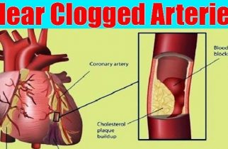 Foods to Prevent Clogged Arteries