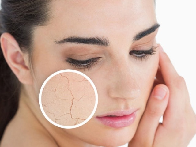 Uses of Bio Oil- Treats Dry Skin